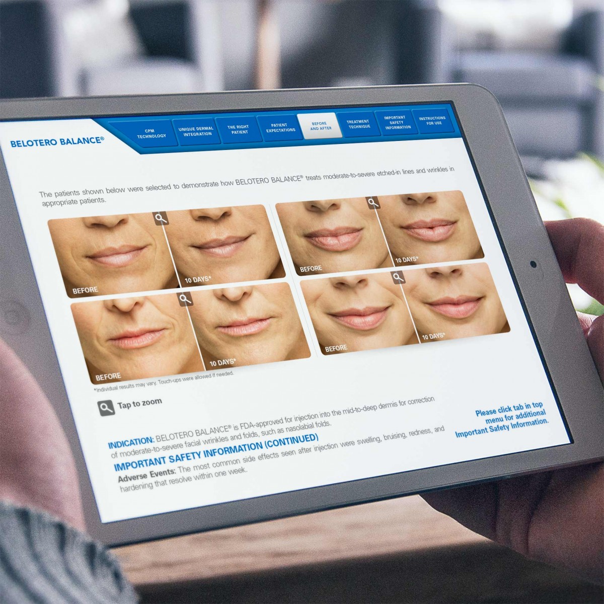 Merz Aesthetics Interactive iPad Salesforce Sales Aid